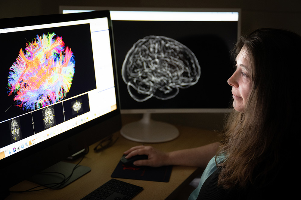 A computer monitor shows a diagrame of a brain