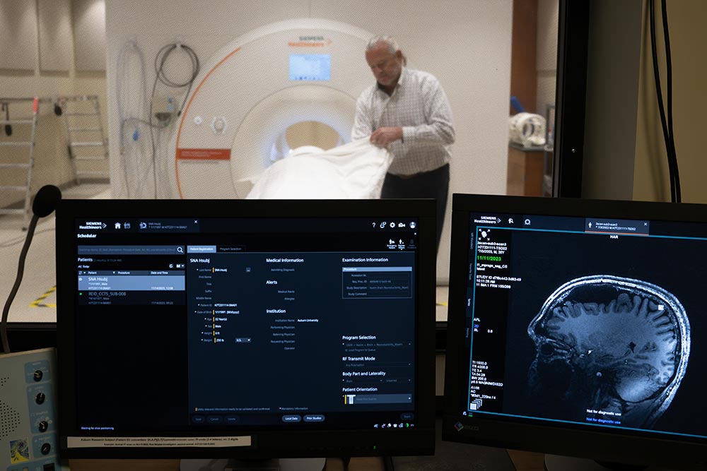 A monitor shows an MRI scan of a brain